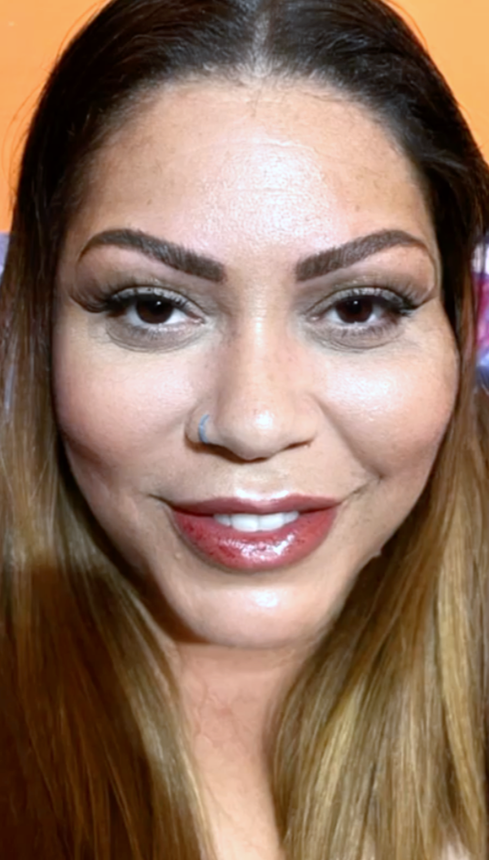 Resultado após procedimento 3