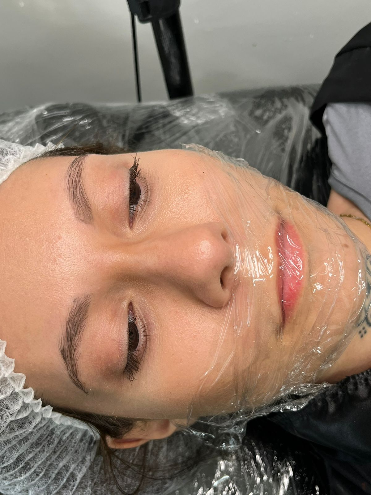 Antes do procedimento 2