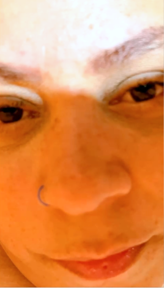 Antes do procedimento 3