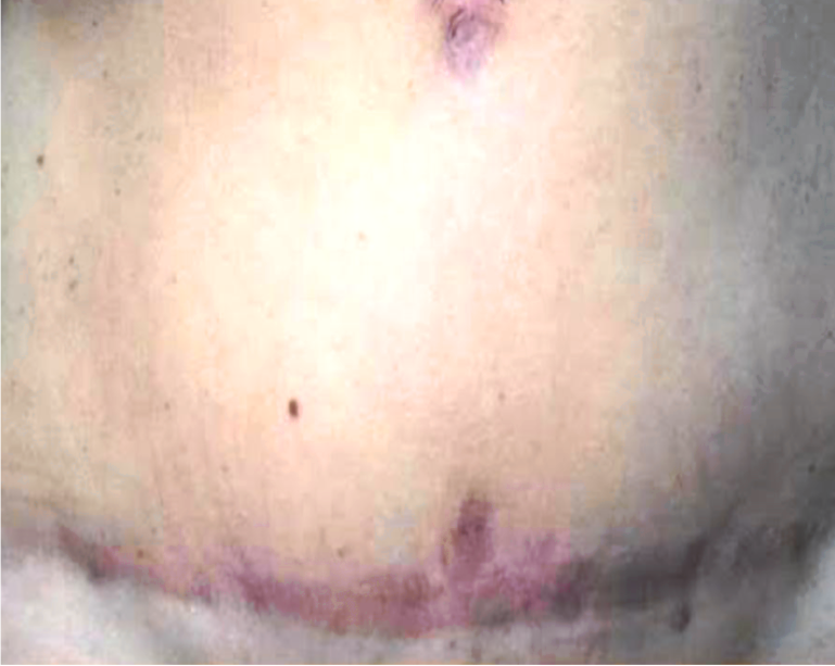 Antes do procedimento 3